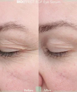 Bioeffect EGF Eye Serum silmänympärysseerumi 6ml