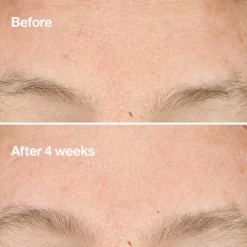 Clinique Clarifying Do-Over Peel kuorintavoide 30 ml