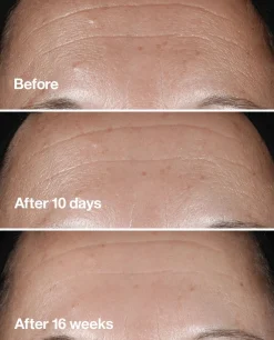 Clinique Smart Clinical Repair Seerumi 50 ml