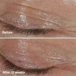 Clinique Smart Clinical Repair Wrinkle Correcting Eye Cream silmänympärysvoide 15 ml