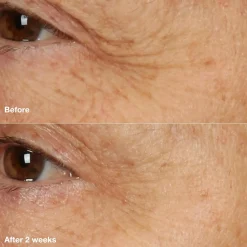 Clinique Smart Clinical Repair Overnight Recovery Cream and Mask yövoide 50 ml