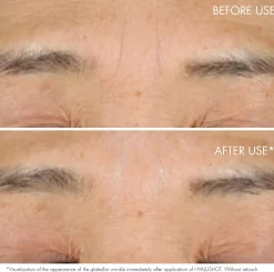 DIOR Capture Totale Hyalushot Wrinkle Corrector 15 ml