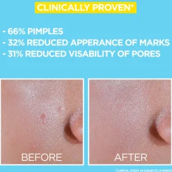 Garnier PureActive uv-voide SPF50 epäpuhtaalle iholle 40 ml