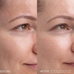 MADARA KOJIC ALTERNATIVE Pigment -seerumi 30ml