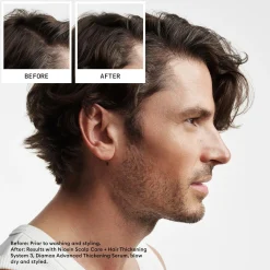 Nioxin System 2 KIT hoitopakkaus 300+300+100 ml