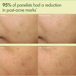 Origins Dr. Weil Mega-Mushroom Dark Spot Brightening Moisturizer -kosteusvoide 50 ml