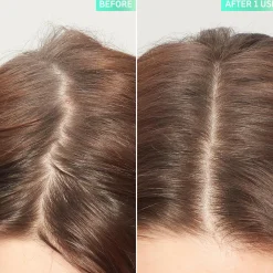 The Inkey List Glycolic Acid Exfoliating Scalp Scrub kuorinta hiuspohjalle 150 ml