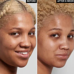 The Inkey List Niacinamide Serum 30 ml