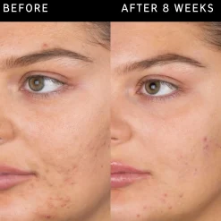 The Inkey List Salicylic Acid Cleanser puhdistusgeeli 60 ml