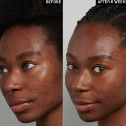 The Inkey List Tranexamic Acid Serum 30 ml