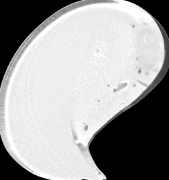 The Ordinary Natural Moisturizing Factors + Beta Glucan kosteusvoide 30 ml