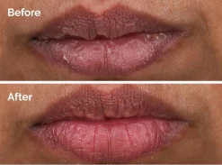 The Ordinary PHA 5% Exfoliating Lip Serum huuliseerumi 15 ml